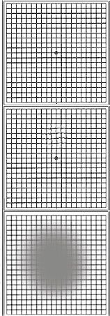 Amslergitter